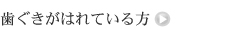 歯ぐきがはれている方