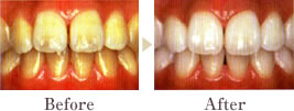 Before��After