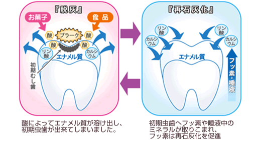 歯医者　桜新町　歯のミネラルパック